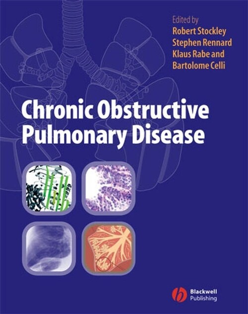 [eBook Code] Chronic Obstructive Pulmonary Disease (eBook Code, 1st)