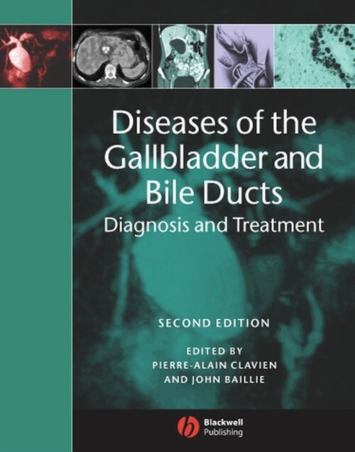 [eBook Code] Diseases of the Gallbladder and Bile Ducts (eBook Code, 2nd)