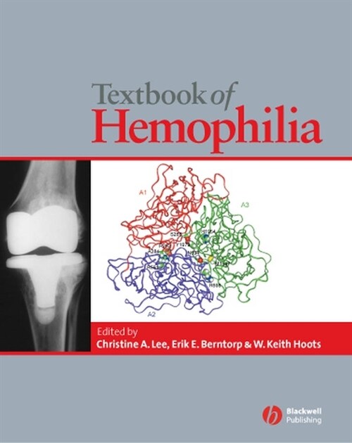 [eBook Code] Textbook of Hemophilia (eBook Code, 1st)