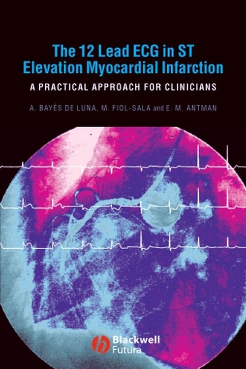 [eBook Code] The 12 Lead ECG in ST Elevation Myocardial Infarction (eBook Code, 1st)