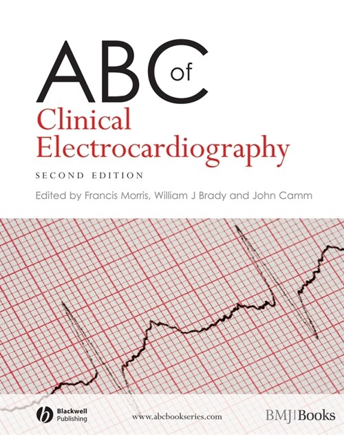 [eBook Code] ABC of Clinical Electrocardiography (eBook Code, 2nd)
