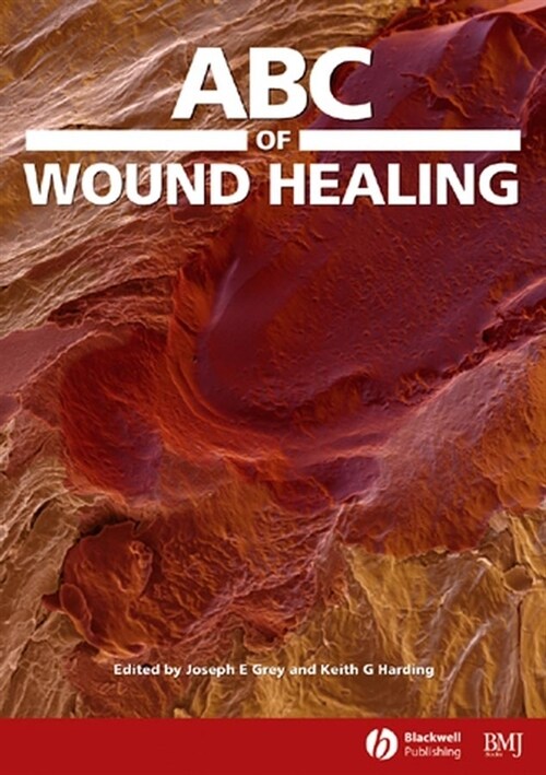 [eBook Code] ABC of Wound Healing (eBook Code, 1st)