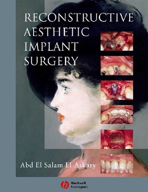[eBook Code] Reconstructive Aesthetic Implant Surgery (eBook Code, 1st)