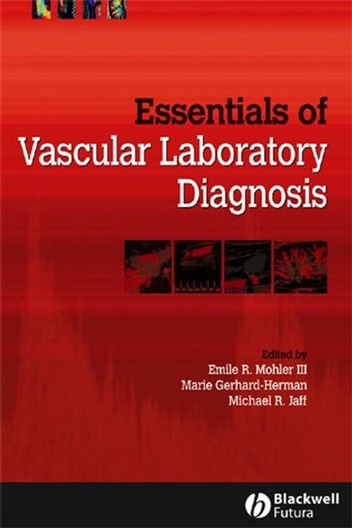 [eBook Code] Essentials of Vascular Laboratory Diagnosis (eBook Code, 1st)