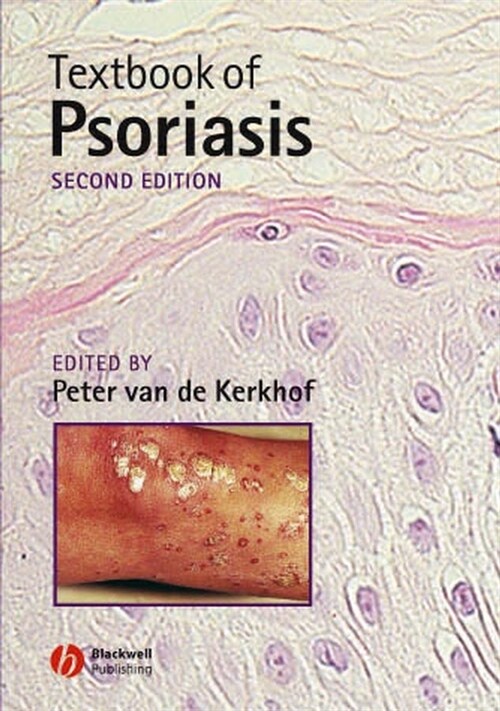 [eBook Code] Textbook of Psoriasis (eBook Code, 2nd)