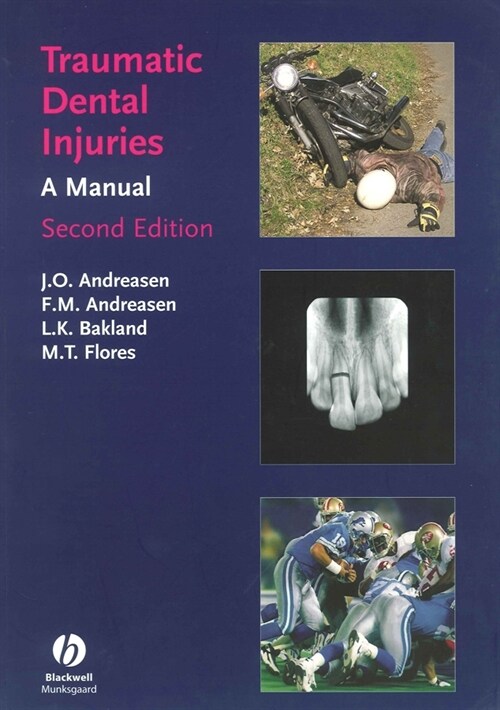[eBook Code] Traumatic Dental Injuries (eBook Code, 2nd)