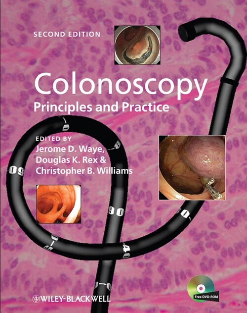 [eBook Code] Colonoscopy (eBook Code, 1st)