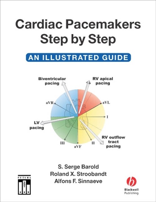 [eBook Code] Cardiac Pacemakers Step by Step (eBook Code, 1st)