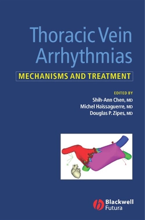 [eBook Code] Thoracic Vein Arrhythmias (eBook Code, 1st)