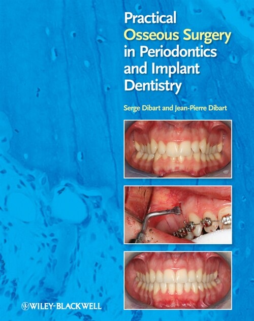 [eBook Code] Practical Osseous Surgery in Periodontics and Implant Dentistry (eBook Code, 1st)