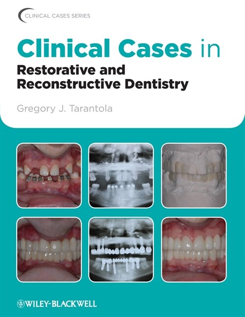 [eBook Code] Clinical Cases in Restorative and Reconstructive Dentistry (eBook Code, 1st)