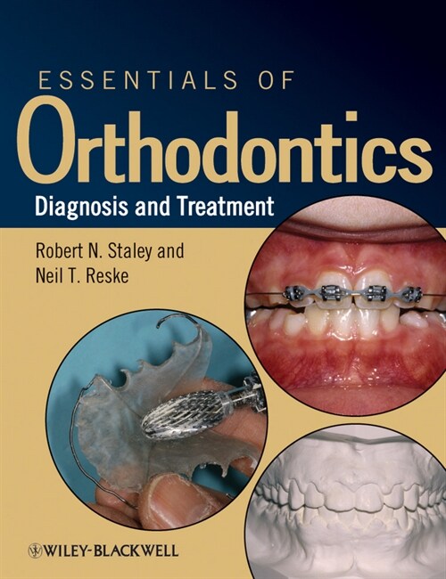 [eBook Code] Essentials of Orthodontics (eBook Code, 1st)