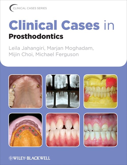 [eBook Code] Clinical Cases in Prosthodontics (eBook Code, 1st)