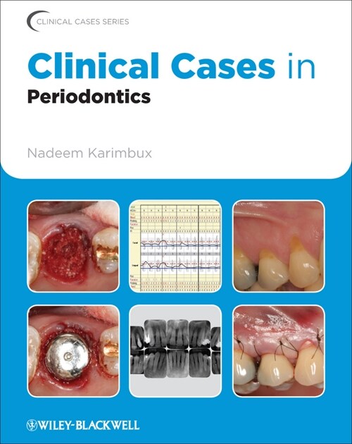 [eBook Code] Clinical Cases in Periodontics (eBook Code, 1st)
