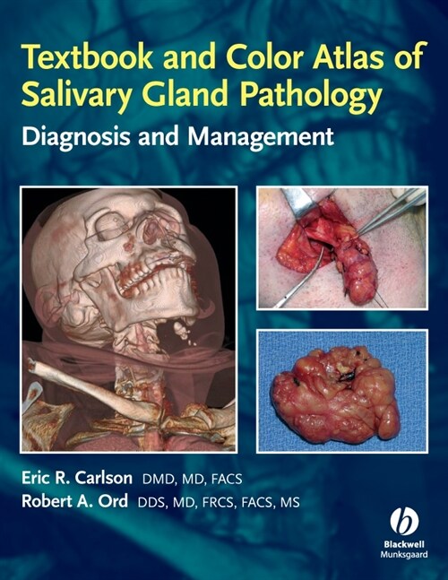 [eBook Code] Textbook and Color Atlas of Salivary Gland Pathology (eBook Code, 1st)