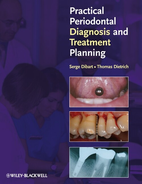 [eBook Code] Practical Periodontal Diagnosis and Treatment Planning (eBook Code, 1st)
