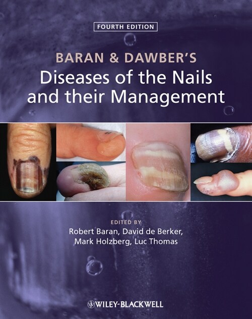 [eBook Code] Baran and Dawbers Diseases of the Nails and their Management (eBook Code, 4th)