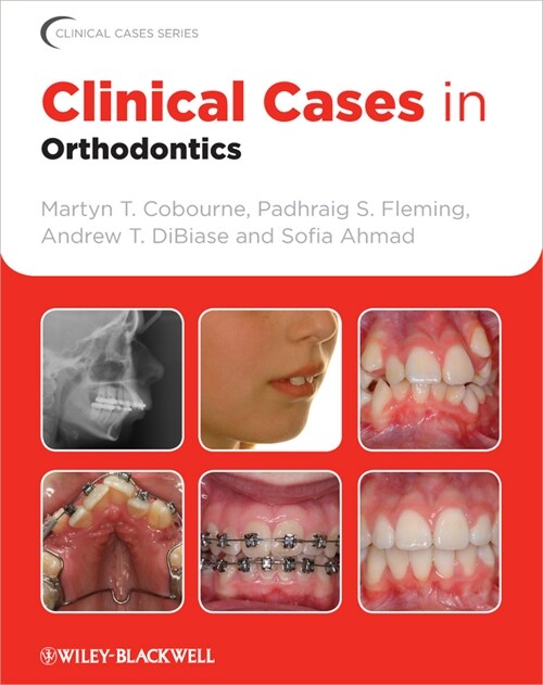 [eBook Code] Clinical Cases in Orthodontics (eBook Code, 1st)