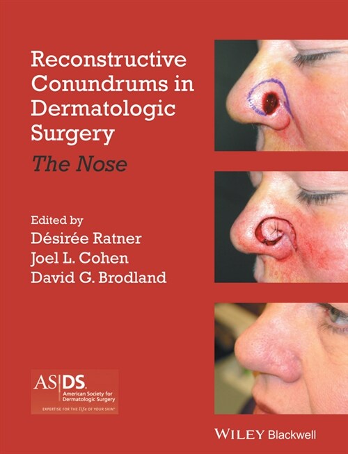 [eBook Code] Reconstructive Conundrums in Dermatologic Surgery (eBook Code, 1st)