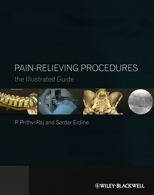 [eBook Code] Pain-Relieving Procedures (eBook Code, 1st)