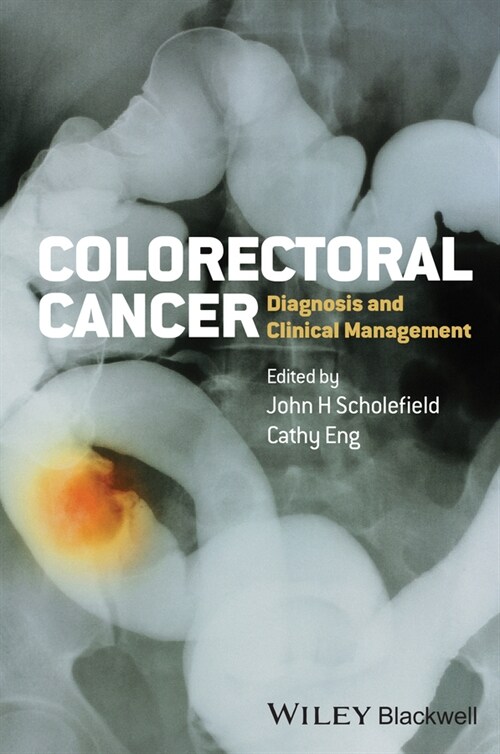 [eBook Code] Colorectal Cancer (eBook Code, 1st)