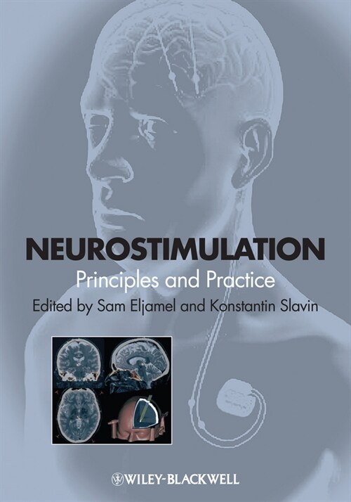 [eBook Code] Neurostimulation (eBook Code, 1st)