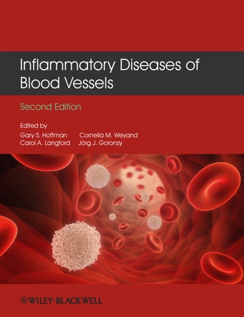 [eBook Code] Inflammatory Diseases of Blood Vessels (eBook Code, 2nd)