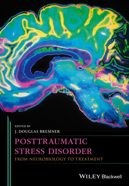 [eBook Code] Posttraumatic Stress Disorder (eBook Code, 1st)