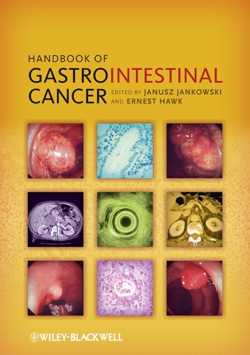 [eBook Code] Handbook of Gastrointestinal Cancer (eBook Code, 1st)