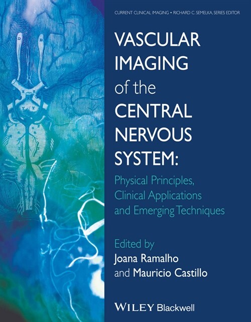 [eBook Code] Vascular Imaging of the Central Nervous System (eBook Code, 1st)