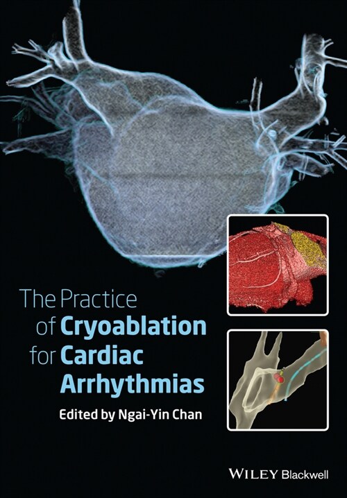 [eBook Code] The Practice of Catheter Cryoablation for Cardiac Arrhythmias (eBook Code, 1st)