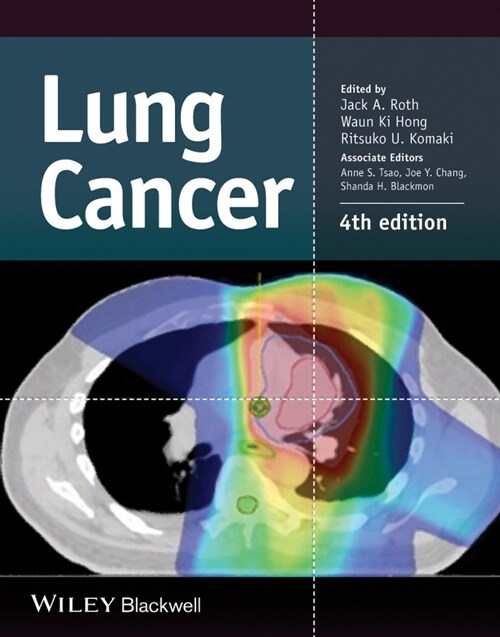 [eBook Code] Lung Cancer (eBook Code, 4th)