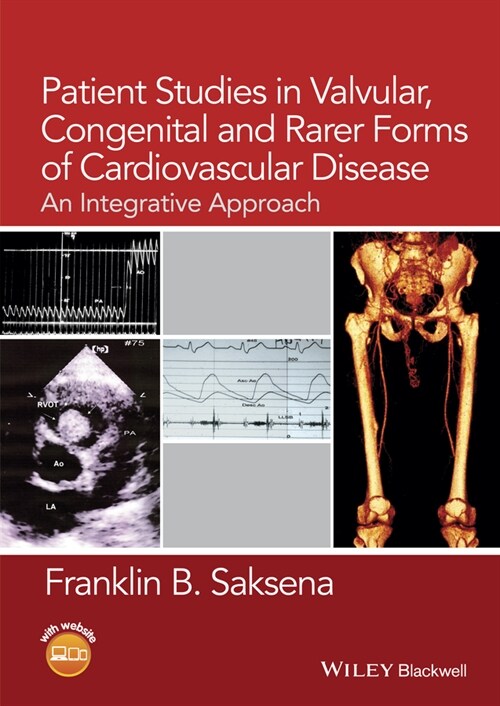 [eBook Code] Patient Studies in Valvular, Congenital, and Rarer Forms of Cardiovascular Disease (eBook Code, 1st)