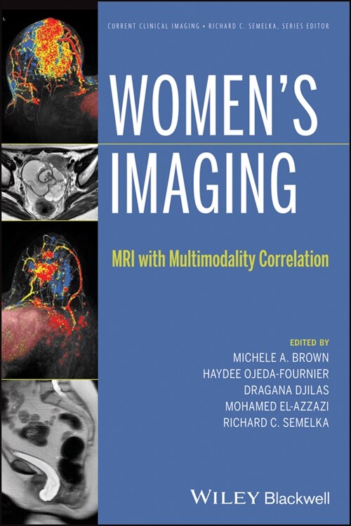 [eBook Code] Womens Imaging (eBook Code, 1st)