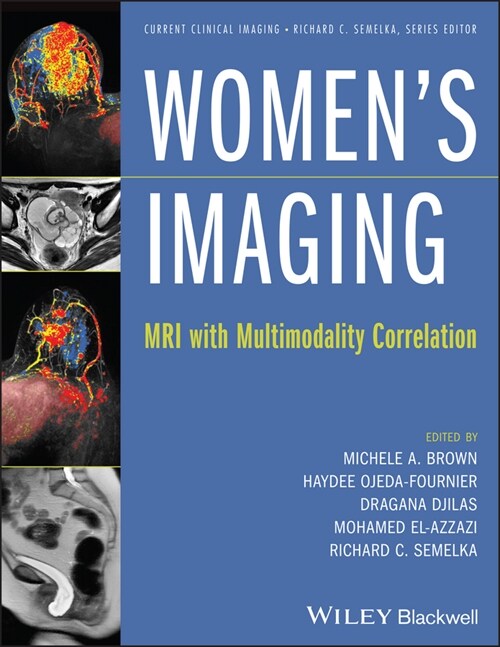 [eBook Code] Womens Imaging (eBook Code, 1st)