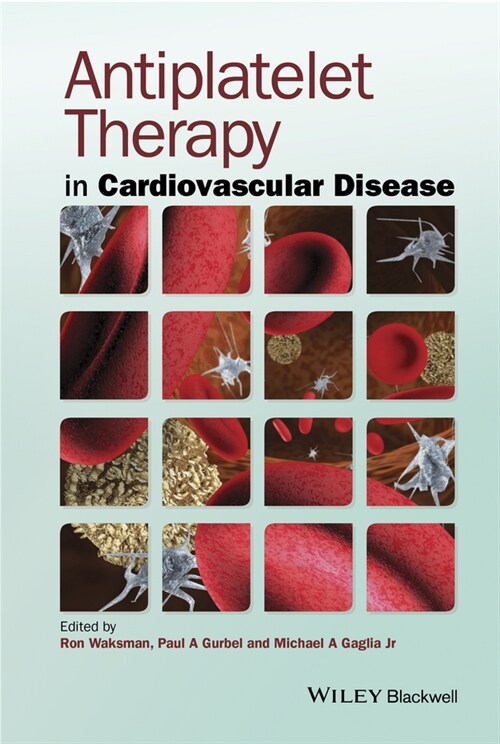 [eBook Code] Antiplatelet Therapy in Cardiovascular Disease (eBook Code, 1st)