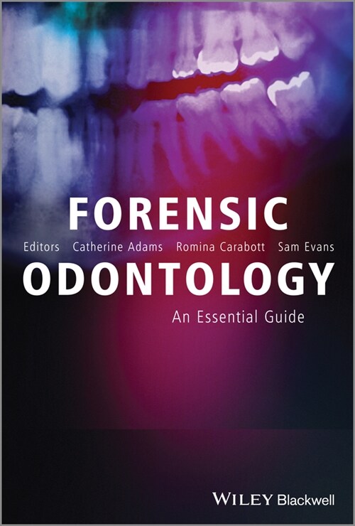 [eBook Code] Forensic Odontology (eBook Code, 1st)