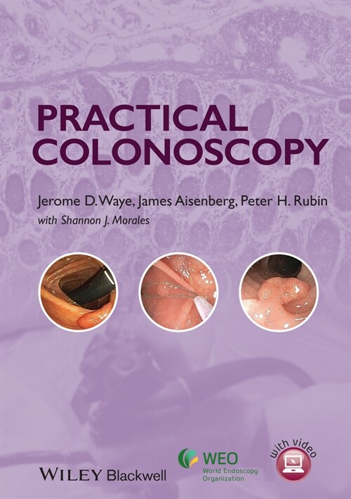 [eBook Code] Practical Colonoscopy (eBook Code, 1st)