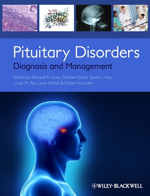 [eBook Code] Pituitary Disorders (eBook Code, 1st)