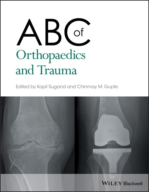 [eBook Code] ABC of Orthopaedics and Trauma (eBook Code, 1st)