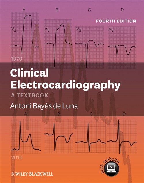 [eBook Code] Clinical Electrocardiography (eBook Code, 4th)