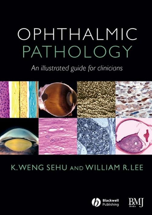 [eBook Code] Ophthalmic Pathology (eBook Code, 1st)