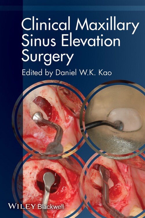 [eBook Code] Clinical Maxillary Sinus Elevation Surgery (eBook Code, 1st)