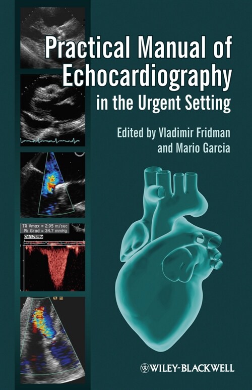 [eBook Code] Practical Manual of Echocardiography in the Urgent Setting (eBook Code, 1st)