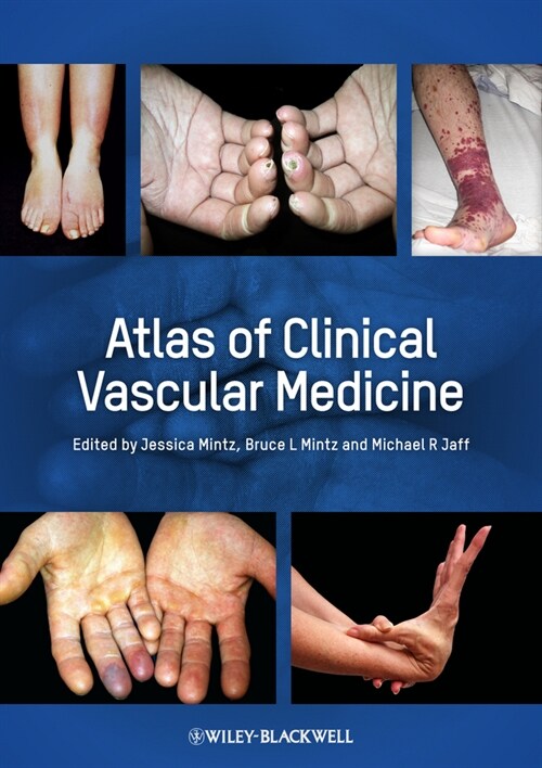 [eBook Code] Atlas of Clinical Vascular Medicine (eBook Code, 1st)
