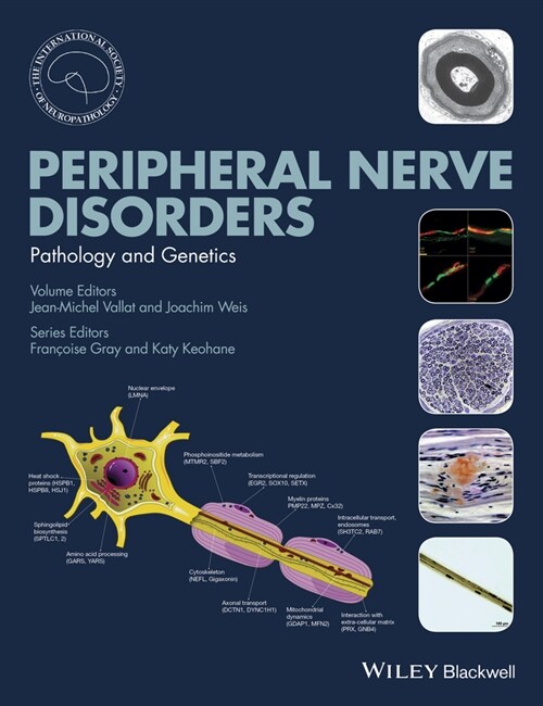 [eBook Code] Peripheral Nerve Disorders (eBook Code, 1st)