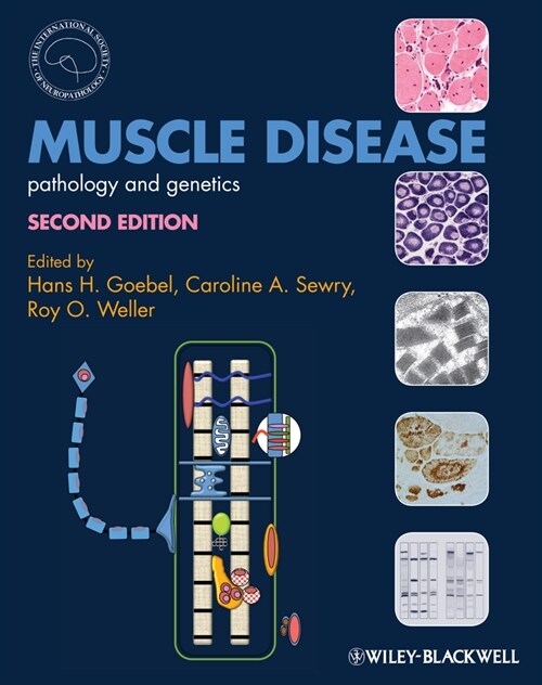 [eBook Code] Muscle Disease (eBook Code, 2nd)