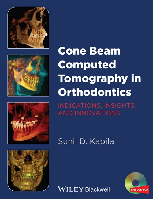 [eBook Code] Cone Beam Computed Tomography in Orthodontics (eBook Code, 1st)