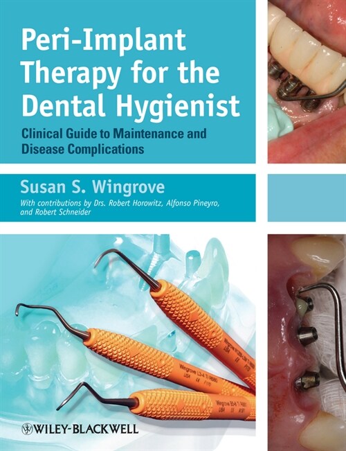 [eBook Code] Peri-Implant Therapy for the Dental Hygienist (eBook Code, 1st)