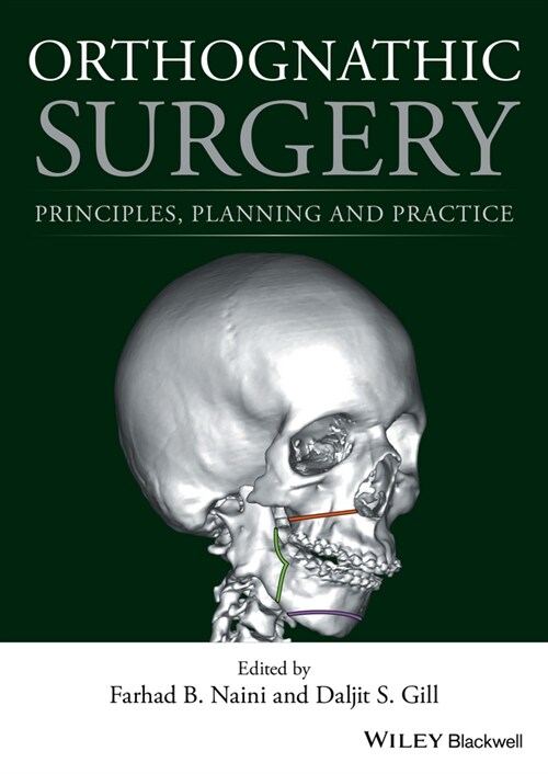 [eBook Code] Orthognathic Surgery (eBook Code, 1st)